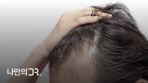 들깨두부는 단백질이 풍부하여 모발 성장과 건강 유지에 도움을 준다.