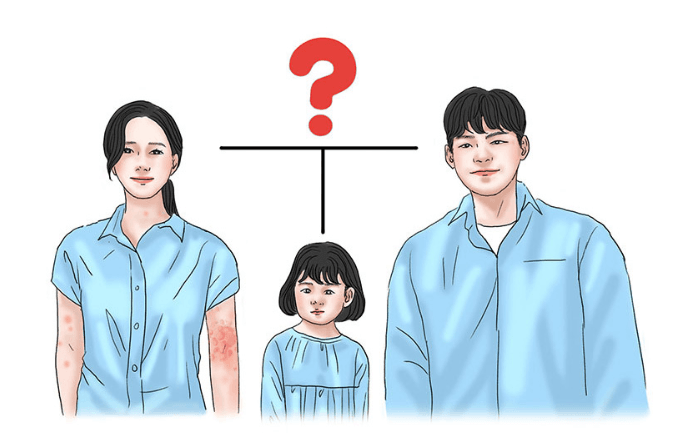 만성두드러기 인포그래픽